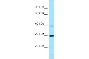 WB Suggested Anti-PROCA1 Antibody Titration: 1.