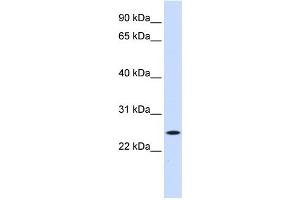 WB Suggested Anti-NOL3 Antibody Titration:  0. (NOL3 Antikörper  (Middle Region))