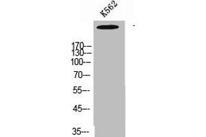 Western Blot analysis of K562 cells using Talin-1 Polyclonal Antibody (TLN1 Antikörper  (C-Term))