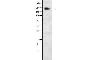 Western blot analysis of ALPK3 using K562 whole cell lysates (ALPK3 Antikörper  (C-Term))