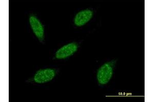 Immunofluorescence of purified MaxPab antibody to RNF20 on HeLa cell. (RNF20 Antikörper  (AA 1-975))