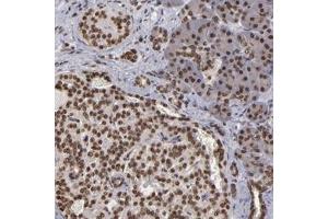 Immunohistochemical staining of human pancreas with CSDC2 polyclonal antibody  shows strong nuclear positivity in both exocrine glandular cells and Islet cells. (CSDC2 Antikörper)