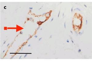IHC Validation of Envelope in COVID-19 Patient Skin: (Magro et al. (SARS-CoV-2 Envelope Antikörper  (N-Term))