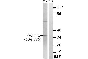 Immunohistochemistry analysis of paraffin-embedded human breast carcinoma tissue using Cyclin C (Phospho-Ser275) antibody. (Cyclin C Antikörper  (pSer275))