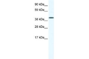 WB Suggested Anti-SOX7 Antibody Titration:  1. (SOX7 Antikörper  (N-Term))