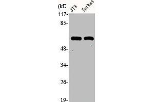 Western Blot analysis of NIH-3T3 Jurkat cells using Cytokeratin 10 Polyclonal Antibody (Cytokeratin 1 Antikörper  (Internal Region))