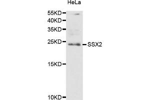 Western blot analysis of extracts of HeLa cells, using SSX2 antibody (ABIN5974203) at 1/1000 dilution.