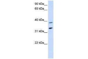 Western Blotting (WB) image for anti-Solute Carrier Family 25, Member 34 (SLC25A34) antibody (ABIN2458822) (SLC25A34 Antikörper)