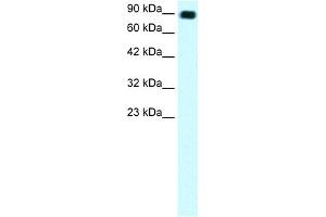 WB Suggested Anti-C13ORF8 Antibody Titration: 1. (ZNF828 Antikörper  (Middle Region))