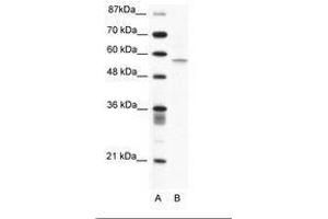 Image no. 1 for anti-Programmed Cell Death 4 (PDCD4) (N-Term) antibody (ABIN203165) (PDCD4 Antikörper  (N-Term))
