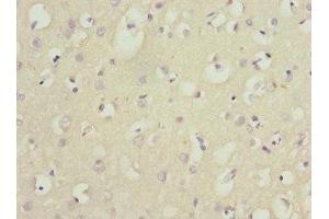 Immunohistochemistry (IHC) image for anti-Nerve Growth Factor Receptor (TNFRSF16) Associated Protein 1 (NGFRAP1) (AA 1-111) antibody (ABIN7165131)