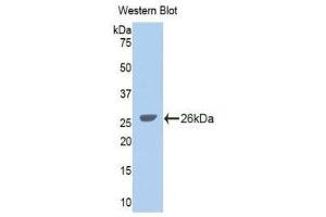 Western Blotting (WB) image for anti-Glycine Dehydrogenase (GLDC) (AA 627-833) antibody (ABIN1859022)
