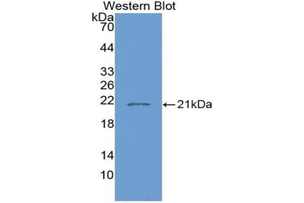 IL-7 antibody  (AA 26-177)