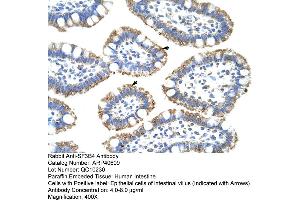 Rabbit Anti-SF3B4 Antibody  Paraffin Embedded Tissue: Human Intestine Cellular Data: Epithelial cells of intestinal villas Antibody Concentration: 4. (SF3B4 Antikörper  (N-Term))