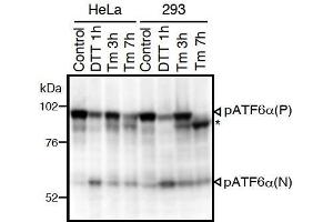 Western Blotting (WB) image for anti-Activating Transcription Factor 6 (ATF6) (N-Term) antibody (ABIN2451924)