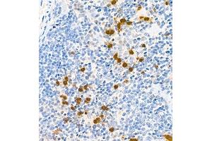 Immunohistochemistry (Paraffin-embedded Sections) (IHC (p)) image for anti-S100 Calcium Binding Protein A9 (S100A9) antibody (ABIN7075497)