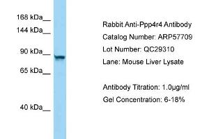 Western Blotting (WB) image for anti-Protein Phosphatase 4, Regulatory Subunit 4 (PPP4R4) (C-Term) antibody (ABIN2787350) (PPP4R4 Antikörper  (C-Term))