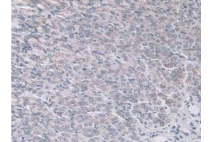 IHC-P analysis of Mouse Stomach Tissue, with DAB staining. (ADAMTS7 Antikörper  (AA 226-437))