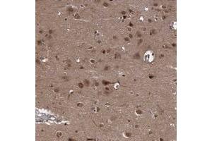Immunohistochemical staining of human cerebral cortex with SYCP2L polyclonal antibody  shows distinct cytoplasmic and nuclear positivity in neuronal cells at 1:200-1:500 dilution. (SYCP2L Antikörper)