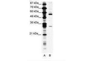 Image no. 1 for anti-Coronin, Actin Binding Protein, 1A (CORO1A) (C-Term) antibody (ABIN305990) (Coronin 1a Antikörper  (C-Term))