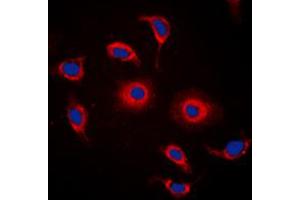 Immunofluorescent analysis of GPR119 staining in HeLa cells.