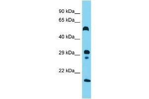 Host: Rabbit  Target Name: Hrh3  Sample Tissue: Rat Small Intestine lysates  Antibody Dilution: 1. (HRH3 Antikörper  (N-Term))