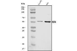 Western blot analysis of HSF4 using anti-HSF4 antibody (ABIN7599790).