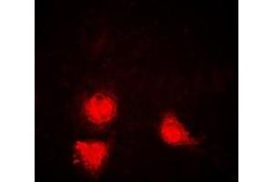 Immunofluorescent analysis of SIRT1 staining in Jurkat cells. (SIRT1 Antikörper)
