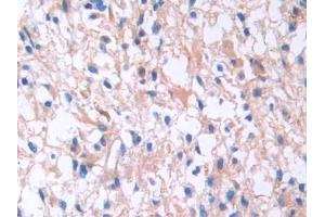 Used in DAB staining on fromalin fixed paraffin- embedded kidney tissue (IL13 Receptor alpha 1 Antikörper  (AA 203-376))