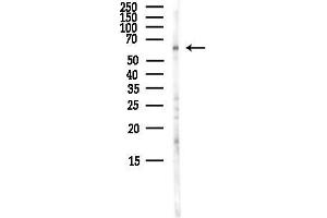 Western blot analysis of lysates from HepG2 cells(LPS,4h treatment), using AFP Antibody at 1/1000 dilution.