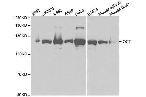 Western blot analysis of extracts of various cell lines, using OGT antibody. (OGT Antikörper  (AA 857-1036))