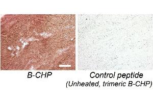 Following heat-mediated antigen retrieval, the complete collagen content in a formalin-fixed (FFPE) section of porcine ligament is visualized non-fluorescently via immunohistochemistry using B-CHP, which is further detected by horseradish peroxidase (HRP) conjugate of NeutrAvidin. (Collagen (COL) peptide (Biotin))
