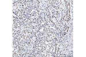 IHC analysis of MCM6 using anti-MCM6 antibody (ABIN7600038). (MCM6 Antikörper  (AA 14-821))