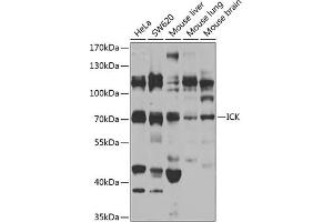 Western blot analysis of extracts of various cell lines, using ICK antibody (ABIN6130510, ABIN6142127, ABIN6142128 and ABIN6223738) at 1:1000 dilution. (ICK Antikörper  (AA 1-270))