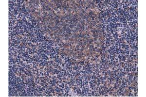 Image no. 8 for anti-COBW Domain Containing 1 (CBWD1) antibody (ABIN1497117) (CBWD1 Antikörper)