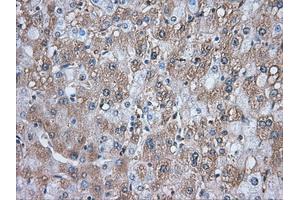 Image no. 9 for anti-Transforming, Acidic Coiled-Coil Containing Protein 3 (TACC3) antibody (ABIN1498099) (TACC3 Antikörper)