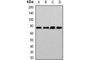 Western blot analysis of Sp110 expression in Jurkat (A), Hela (B), mouse liver (C), rat brain (D) whole cell lysates. (SP110 Antikörper)