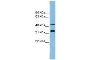 Image no. 1 for anti-Golgi Reassembly Stacking Protein 1, 65kDa (GORASP1) (AA 35-84) antibody (ABIN6745200) (GORASP1 Antikörper  (AA 35-84))