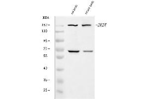 Western blot analysis of BRDT using anti-BRDT antibody (ABIN7602468).