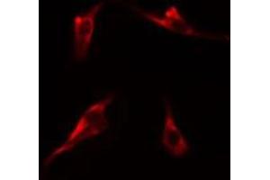 ABIN6275227 staining  Hela cells by IF/ICC. (MBTPS1 Antikörper  (Internal Region))