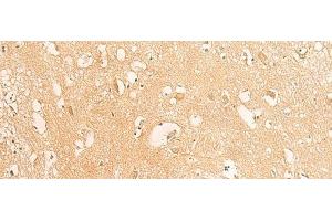Immunohistochemistry of paraffin-embedded Human brain tissue using IFITM2 Polyclonal Antibody at dilution of 1:25(x200) (IFITM2 Antikörper)