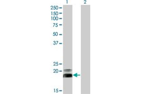 HAND2 Antikörper  (AA 135-216)