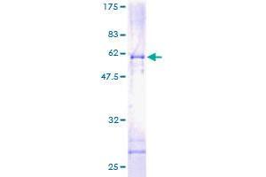 SDS-PAGE (SDS) image for Etoposide Induced 2.4 (EI24) (AA 1-340) protein (GST tag) (ABIN1788854) (EI24 Protein (AA 1-340) (GST tag))