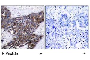 Image no. 1 for anti-Gap Junction Protein, alpha 1, 43kDa (GJA1) (pSer367), (pSer368) antibody (ABIN197019) (Connexin 43/GJA1 Antikörper  (pSer367, pSer368))