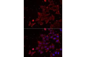 Immunofluorescence analysis of NIH/3T3 cells using MSRA Rabbit pAb (ABIN6128249, ABIN6144086, ABIN6144088 and ABIN6222015) at dilution of 1:350 (40x lens). (MSRA Antikörper  (AA 24-235))