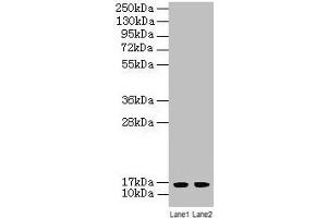 Western blot All lanes: LSM4 antibody at 2 μg/mL Lane 1: A549 whole cell lysate Lane 2: K562 whole cell lysate Secondary Goat polyclonal to rabbit IgG at 1/10000 dilution Predicted band size: 16 kDa Observed band size: 16 kDa (LSM4 Antikörper  (AA 1-139))