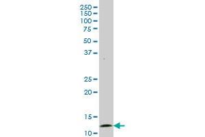 GHRL monoclonal antibody (M06), clone 4E5. (Ghrelin Antikörper  (AA 1-117))