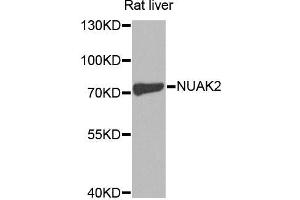Western blot analysis of extracts of rat liver, using NUAK2 antibody (ABIN5970437) at 1/1000 dilution.