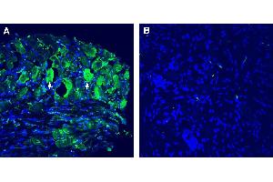 Expression of TMEM150C in rat dorsal root ganglia (DRG). (TMEM150C Antikörper  (Extracellular))