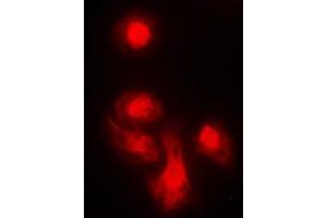 Immunofluorescent analysis of KIF4A staining in MCF7 cells.
